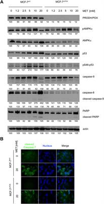 Metformin Induces PRODH/POX-Dependent Apoptosis in Breast Cancer Cells